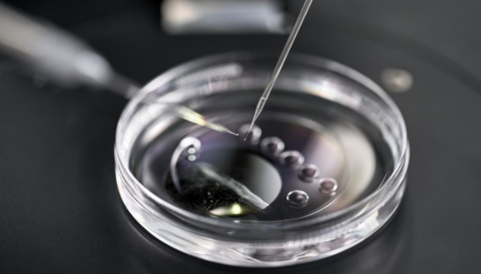 IVF Transfer In Laboratory